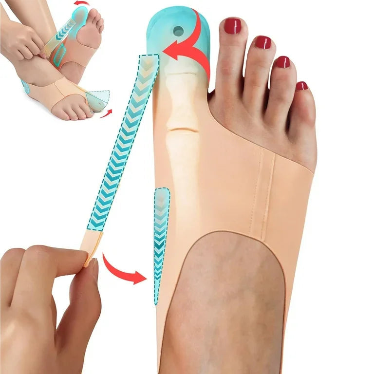 Bunion™ 2.0: As meias corretoras originais para joanetes