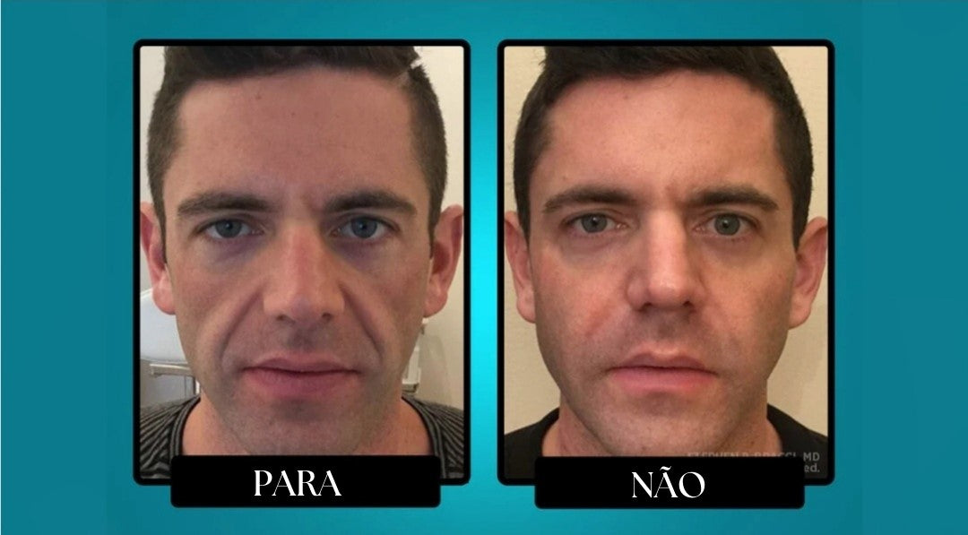 Bálsamo de sebo para defesa contra rugas