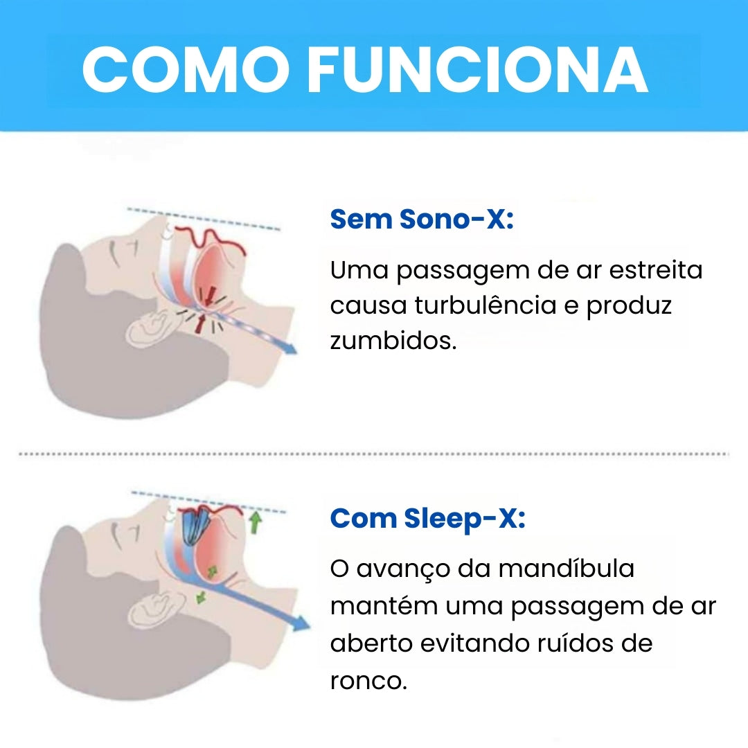 Sleep-X