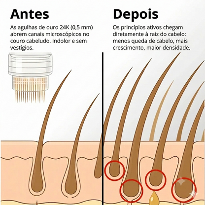Sistema de crescimento capilar Apex