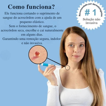 MyPeau™ Acabaram-se as marcas na pele!