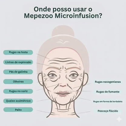 Sistema de Microinfusão™