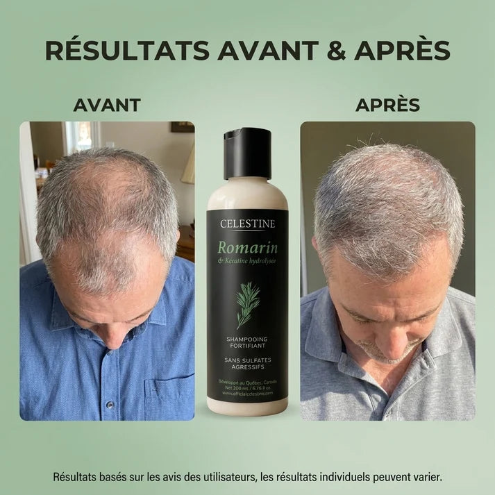 Champô de Alecrim e Queratina para um Cabelo Mais Espesso