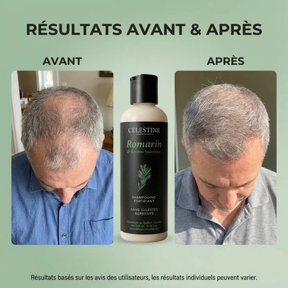 Champô de Alecrim e Queratina para um Cabelo Mais Espesso