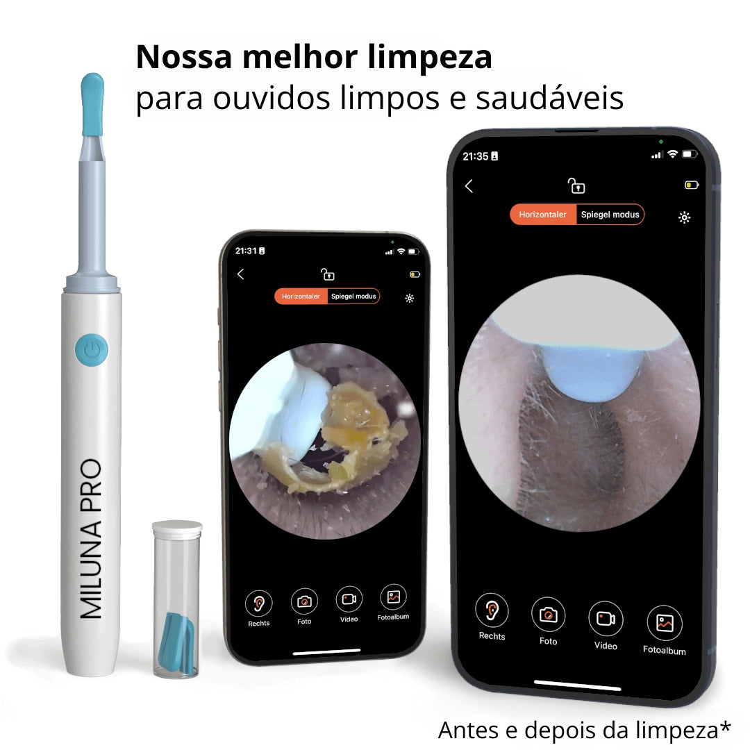 Limpador de ouvidos inteligente com câmara HD