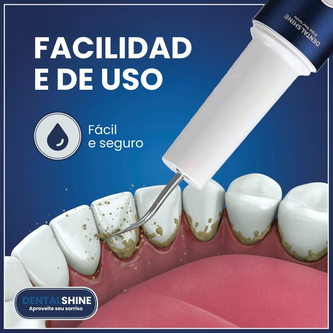 Um sorriso mais branco e uma boca mais saudável, novo raspador ultrassónico Dentalshine!