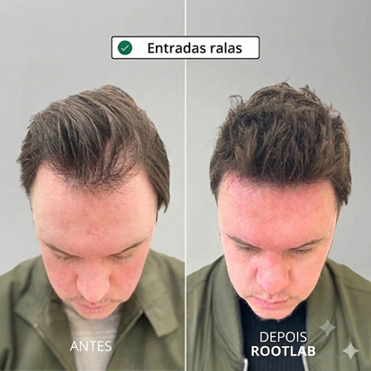Sistema de crescimento capilar Apex