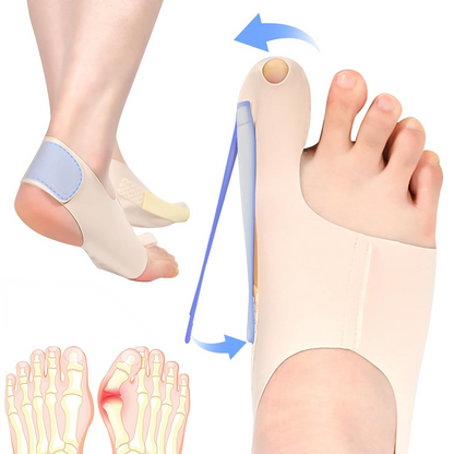 Bunion™ 2.0: As meias corretoras originais para joanetes