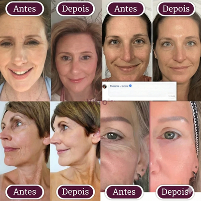 Bálsamo facial de colagénio e cálcio