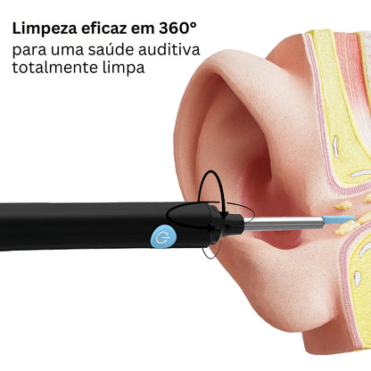 Limpador de ouvidos inteligente com câmara HD