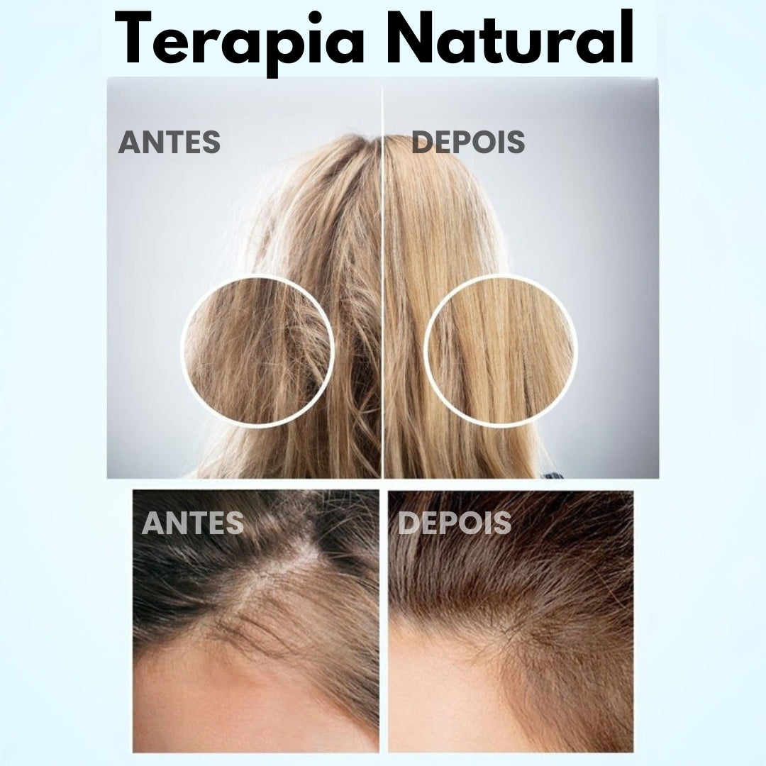 Mepezo- Escova 4 em 1 com terapia de luz