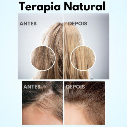 Mepezo- Escova 4 em 1 com terapia de luz