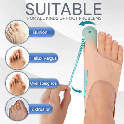 Bunion™ 2.0: As meias corretoras originais para joanetes