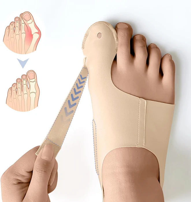 Bunion™ 2.0: As meias corretoras originais para joanetes