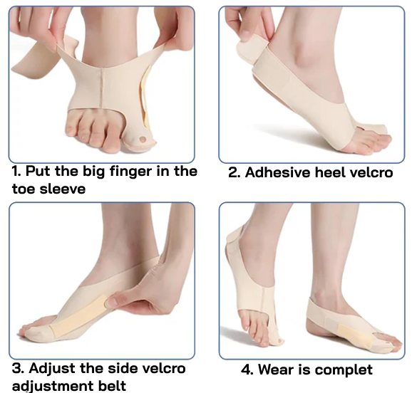 Bunion™ 2.0: As meias corretoras originais para joanetes