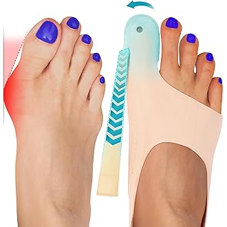 Bunion™ 2.0: As meias corretoras originais para joanetes