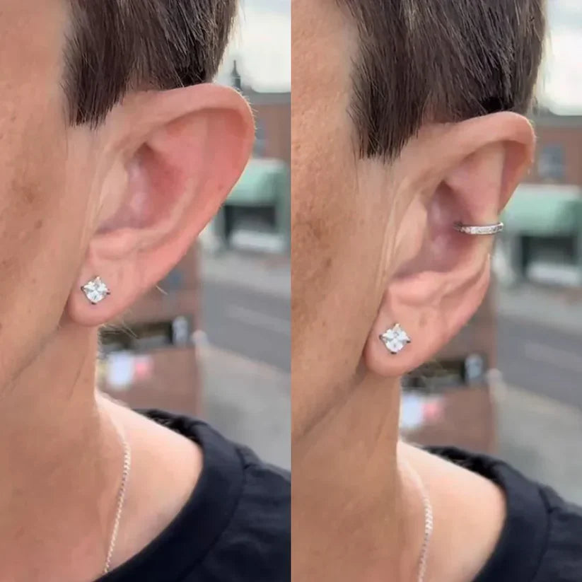 Earfix – Corretor de Orelhas Reutilizável para Resultados Naturais
