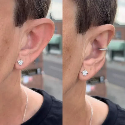Earfix – Corretor de Orelhas Reutilizável para Resultados Naturais