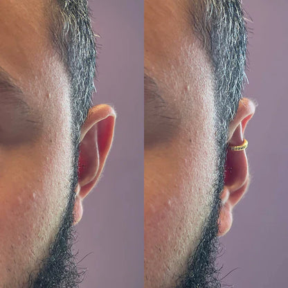 Earfix – Corretor de Orelhas Reutilizável para Resultados Naturais
