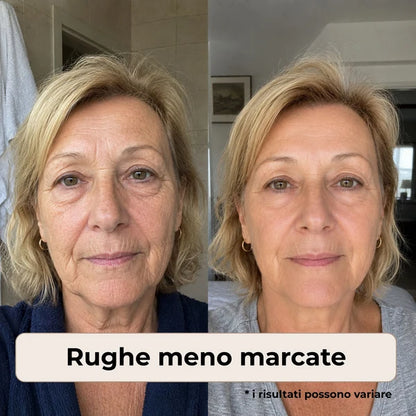 Creme Anti-Idade Mepezoo™